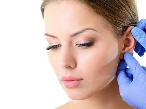 FINANCIACION OTOPLASTIA